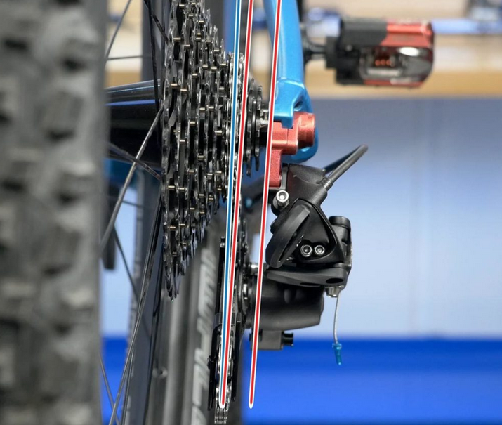 کج بودن شانژمان