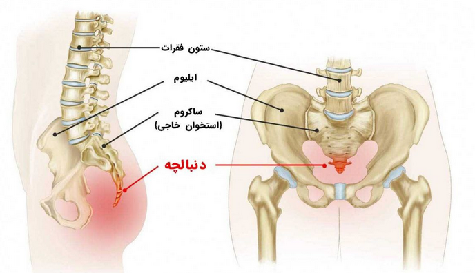 برطرف‌کردن درد نشیمنگاه در دوچرخه سواری
